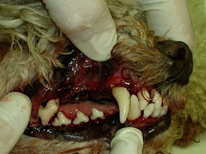 Foto: Odstranění zubního kamene ultrazvukem