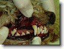 Odstranění zubního kamene ultrazvukem