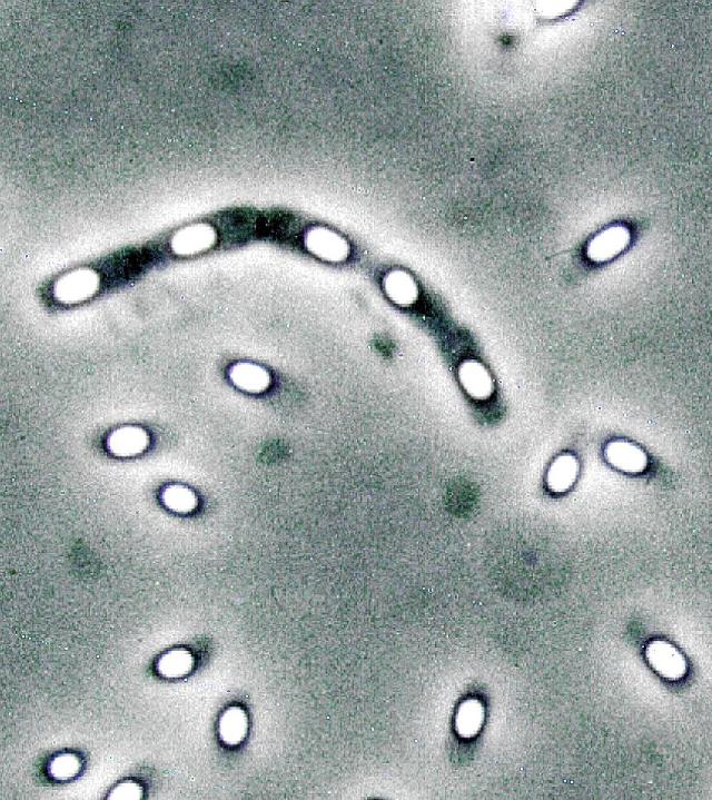 Foto k novince: Uv dt spe v bakterie nebo v pnaboha?