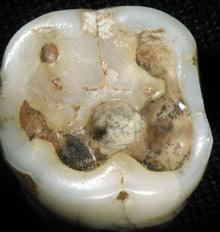 Foto k novince: Zubn vrtaky podle vdc lid vyvinuli u ped 9000 lety